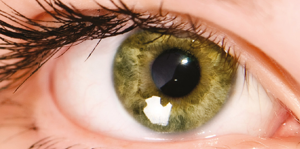3d-oct-screening